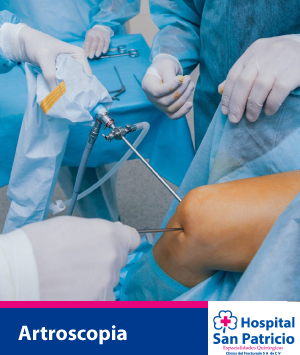 artroscopia