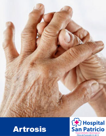 artrosis
