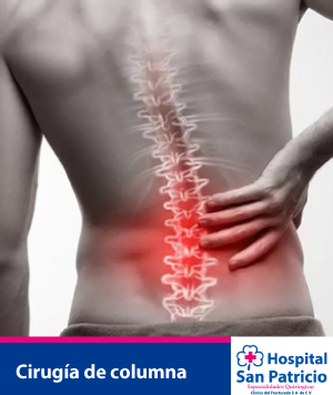 Cirugia de columna